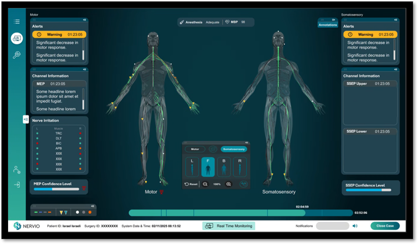 Graphic user interface for Nervio’s AIM neuromonitoring platform