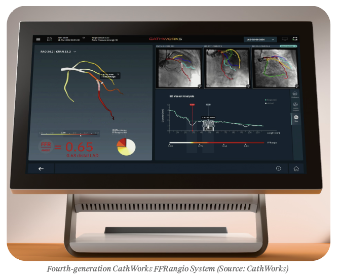 Fourth-generation CathWorks FFRangio System